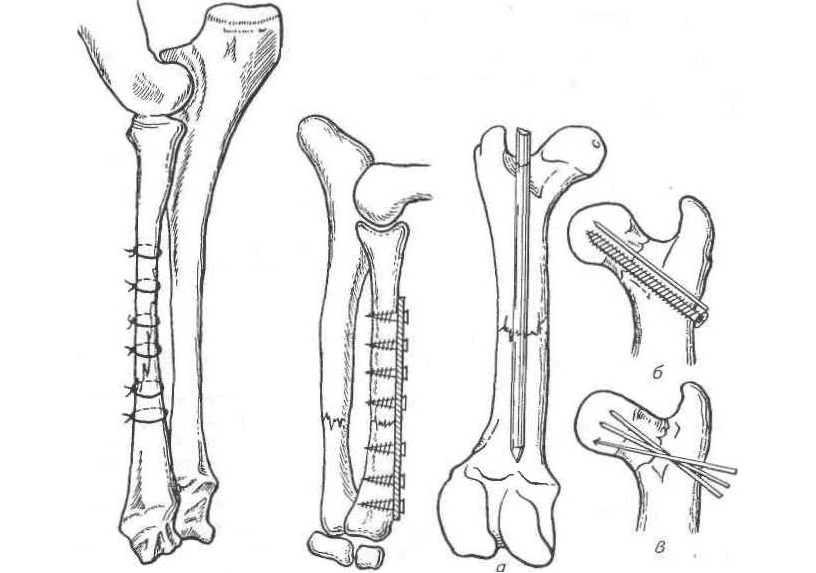Стерильная кость