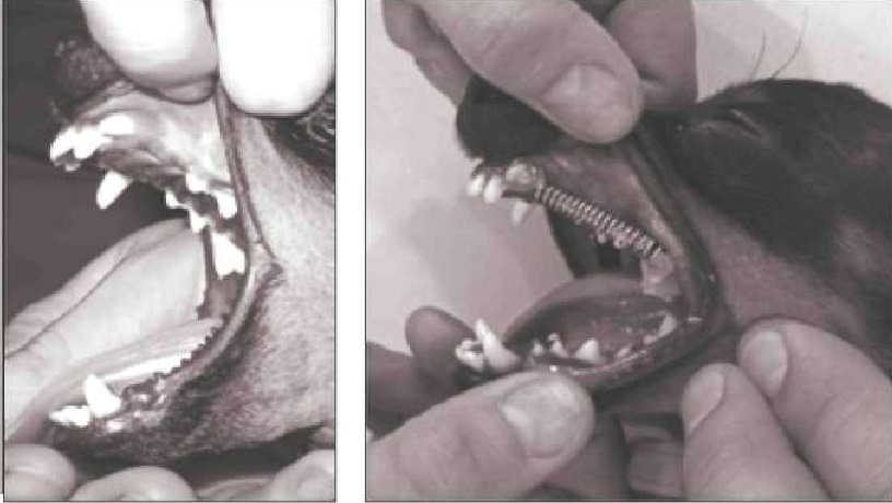 ортодонтическое приспособление